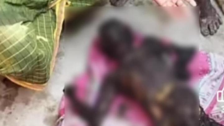 নরসিংদীর চরাঞ্চলে বসতঘরে আগুন, অগ্নিদগ্ধ হয়ে শিশুর মৃত্যু